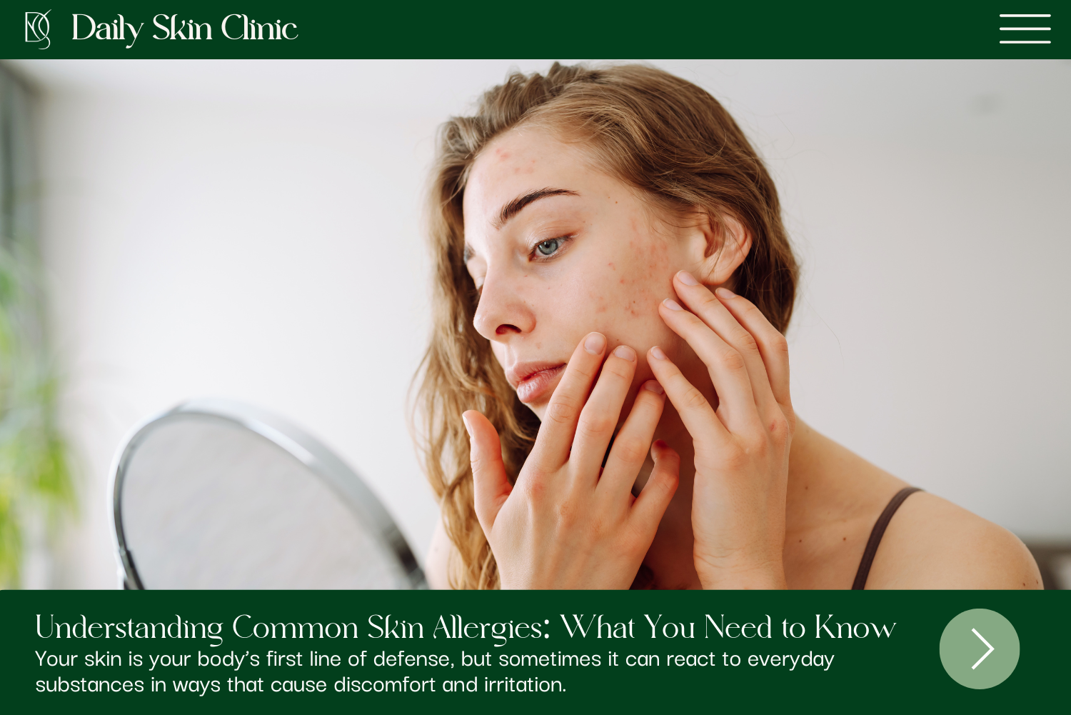 Understanding Common Skin Allergies: What You Need to Know