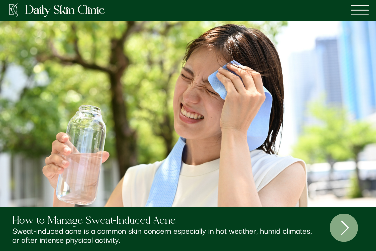 How to Manage Sweat-Induced Acne