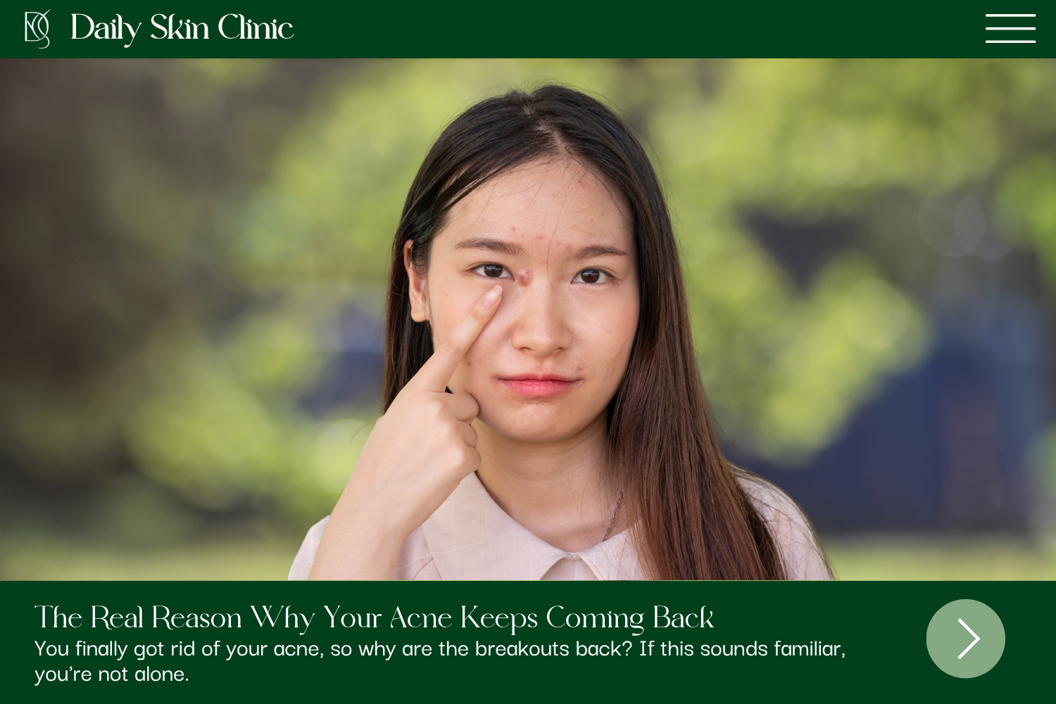 The Real Reason Why Your Acne Keeps Coming Back